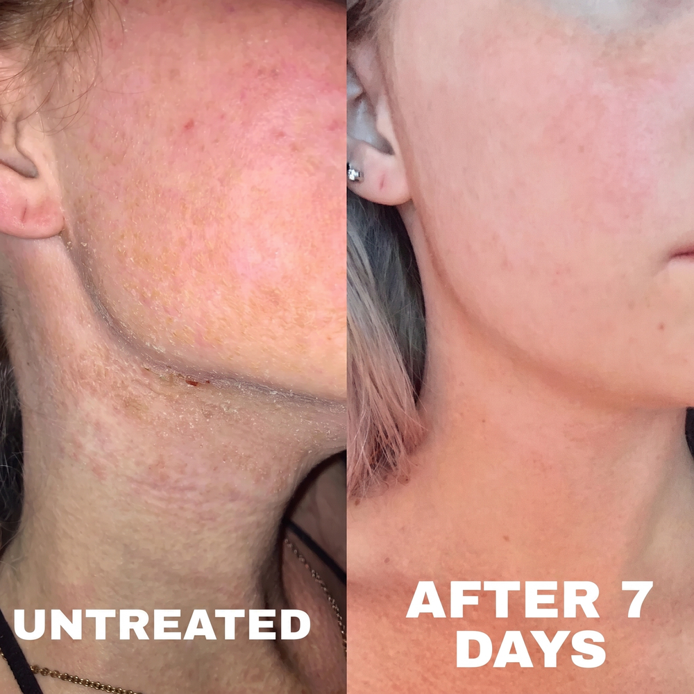 4. Notice calmer skin within the first few days (Instead of weeks or months)